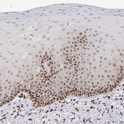 XPC Antibody, Novus Biologicals:Antibodies:Primary Antibodies