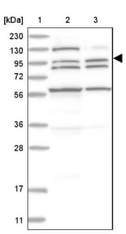 XPC Antibody, Novus Biologicals:Antibodies:Primary Antibodies
