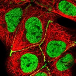 XPE/DDB2 Antibody, Novus Biologicals 25 &mu;L, Unlabeled:Antibodies, Polyclonal