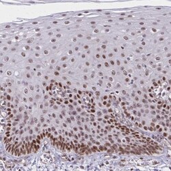 XPE/DDB2 Antibody, Novus Biologicals 25 &mu;L, Unlabeled:Antibodies, Polyclonal