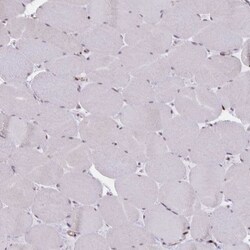 XPE/DDB2 Antibody, Novus Biologicals 25 &mu;L, Unlabeled:Antibodies, Polyclonal