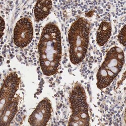 XPNPEP3 Antibody, Novus Biologicals:Antibodies:Primary Antibodies