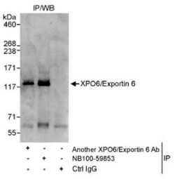 XPO6 Antibody, Novus Biologicals 0.1mg; Unlabeled:Antibodies, Polyclonal