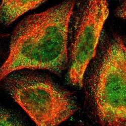 XPV/DNA polymerase eta Antibody, Novus Biologicals 0.1mL; Unlabeled:Antibodies,