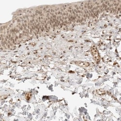 XPV/DNA polymerase eta Antibody, Novus Biologicals 0.1 mL | Buy Online | Novus Biologicals | Fisher Scientific