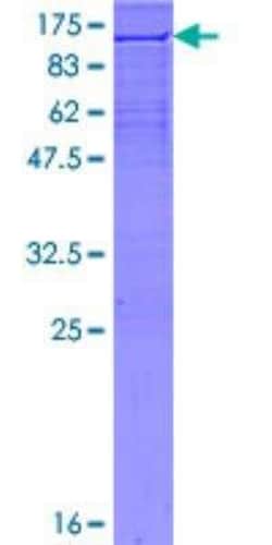 Novus Biologicals™ Recombinant Human XRCC1 GST (N-Term) Protein