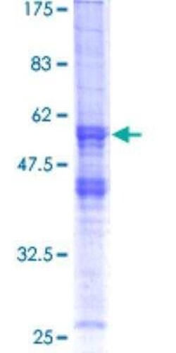 Novus Biologicals Recombinant Human XRCC2 GST (N-Term) Protein 10 &mu;g | Buy Online | Novus Biologicals&trade; | Fisher Scientific