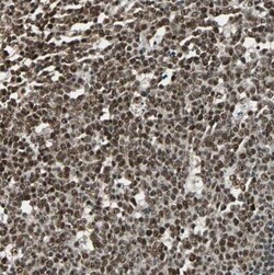 XRCC4 Antibody, Novus Biologicals 25 &mu;L | Buy Online | Novus Biologicals | Fisher Scientific