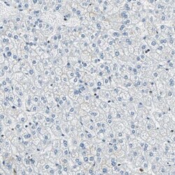 XRCC4 Antibody, Novus Biologicals 25 &mu;L | Buy Online | Novus Biologicals | Fisher Scientific