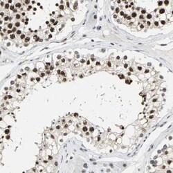 XRCC4 Antibody, Novus Biologicals 25 &mu;L | Buy Online | Novus Biologicals | Fisher Scientific