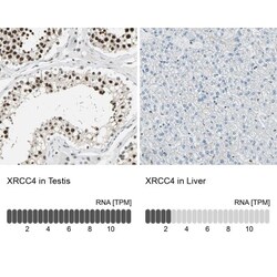 XRCC4 Antibody, Novus Biologicals 25 &mu;L | Buy Online | Novus Biologicals | Fisher Scientific