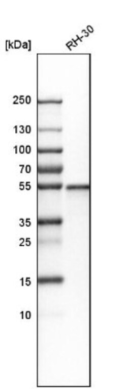 XRCC4 Antibody, Novus Biologicals 25 &mu;L | Buy Online | Novus Biologicals | Fisher Scientific