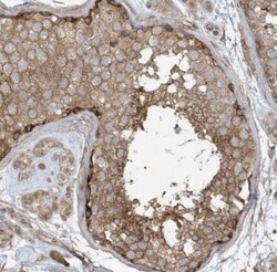 XRCC6BP1 Antibody, Novus Biologicals:Antibodies:Primary Antibodies