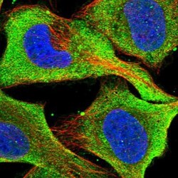 Xrn1 Antibody, Novus Biologicals 25 &mu;L | Buy Online | Novus Biologicals | Fisher Scientific