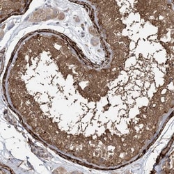 Xrn1 Antibody, Novus Biologicals 25 &mu;L | Buy Online | Novus Biologicals | Fisher Scientific