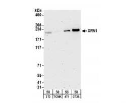 Xrn1 Antibody, Novus Biologicals 0.1mL; Unlabeled:Antibodies, Polyclonal
