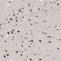 YAF2 Antibody, Novus Biologicals:Antibodies:Primary Antibodies