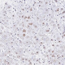 YAP1 Antibody, Novus Biologicals 0.1mL; Unlabeled:Antibodies, Polyclonal