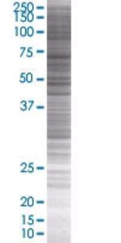Novus Biologicals YAP1 293T Cell Transient Overexpression Lysate 0.1 mL | Buy Online | Novus Biologicals&trade; | Fisher Scientific