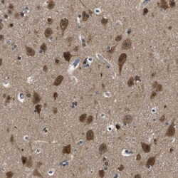 YARS Antibody, Novus Biologicals 0.1mL; Unlabeled:Antibodies, Polyclonal