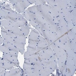 YARS Antibody, Novus Biologicals 0.1mL; Unlabeled:Antibodies, Polyclonal