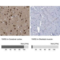 YARS Antibody, Novus Biologicals 0.1mL; Unlabeled:Antibodies, Polyclonal