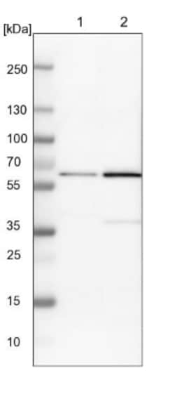 YARS Antibody, Novus Biologicals 0.1mL; Unlabeled:Antibodies, Polyclonal
