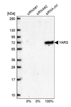 YARS Antibody, Novus Biologicals 0.1mL; Unlabeled:Antibodies, Polyclonal