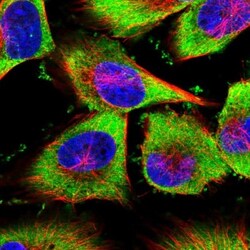 YB1 Antibody, Novus Biologicals 0.1mL; Unlabeled:Antibodies, Polyclonal