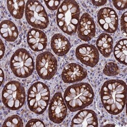 YB1 Antibody, Novus Biologicals 0.1mL; Unlabeled:Antibodies, Polyclonal