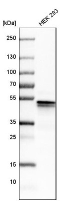 YB1 Antibody, Novus Biologicals 0.1mL; Unlabeled:Antibodies, Polyclonal