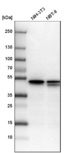 YB1 Antibody, Novus Biologicals 0.1mL; Unlabeled:Antibodies, Polyclonal