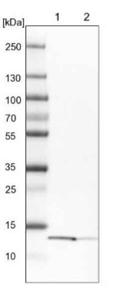 YBEY Antibody, Novus Biologicals 25 &mu;L | Buy Online | Novus Biologicals | Fisher Scientific
