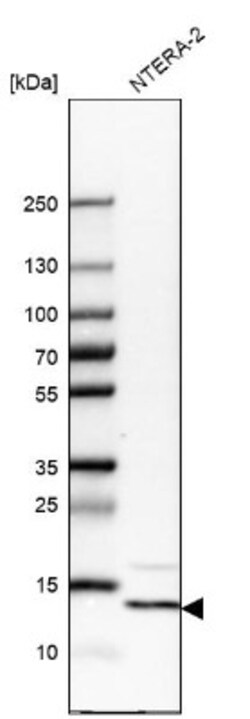 YBEY Antibody, Novus Biologicals 25 &mu;L | Buy Online | Novus Biologicals | Fisher Scientific