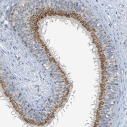 YIPF3 Antibody, Novus Biologicals 0.1mL; Unlabeled:Antibodies, Polyclonal
