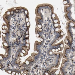 YIPF4 Antibody, Novus Biologicals:Antibodies:Primary Antibodies