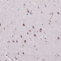 YLPM1 Antibody, Novus Biologicals 25ul | Buy Online | Novus Biologicals | Fisher Scientific