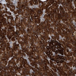YRDC Antibody, Novus Biologicals 25 &mu;L | Buy Online | Novus Biologicals | Fisher Scientific