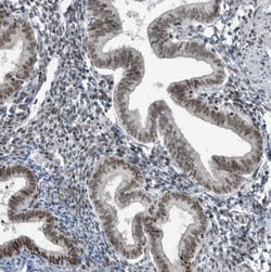 YTHDC1 Antibody, Novus Biologicals:Antibodies:Primary Antibodies