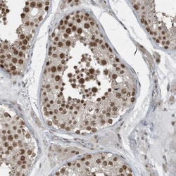 YTHDC1 Antibody, Novus Biologicals:Antibodies:Primary Antibodies