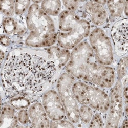 YTHDC1 Antibody, Novus Biologicals:Antibodies:Primary Antibodies