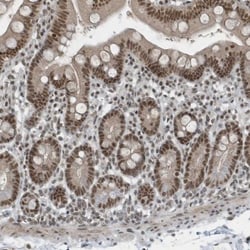 YTHDC1 Antibody, Novus Biologicals:Antibodies:Primary Antibodies