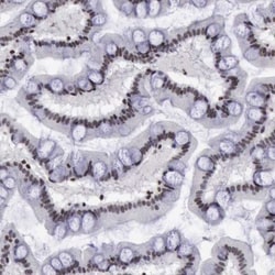YY1 Antibody, Novus Biologicals 0.1mL; Unlabeled:Antibodies, Polyclonal