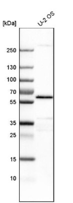 Yes Antibody, Novus Biologicals 25 &mu;L; Unlabeled:Antibodies, Polyclonal