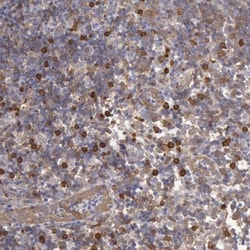 Ymer Antibody, Novus Biologicals 25 &mu;L | Buy Online | Novus Biologicals | Fisher Scientific