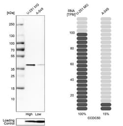 Ymer Antibody, Novus Biologicals 25 &mu;L | Buy Online | Novus Biologicals | Fisher Scientific