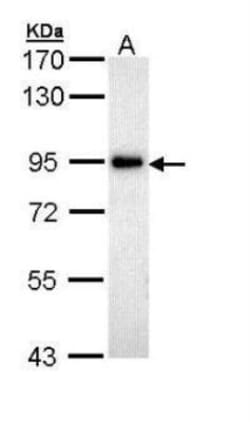 ZAK Antibody, Novus Biologicals 0.1mg; Unlabeled:Antibodies, Polyclonal