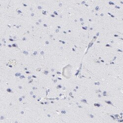 ASB6 Antibody, Novus Biologicals:Antibodies:Primary Antibodies