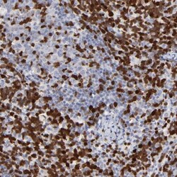 ASB6 Antibody, Novus Biologicals:Antibodies:Primary Antibodies