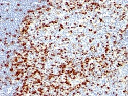 ZAP70 Antibody (ZAP70/528 + 2F3.2), Novus Biologicals 0.2mg; Unlabeled:Antibodies,